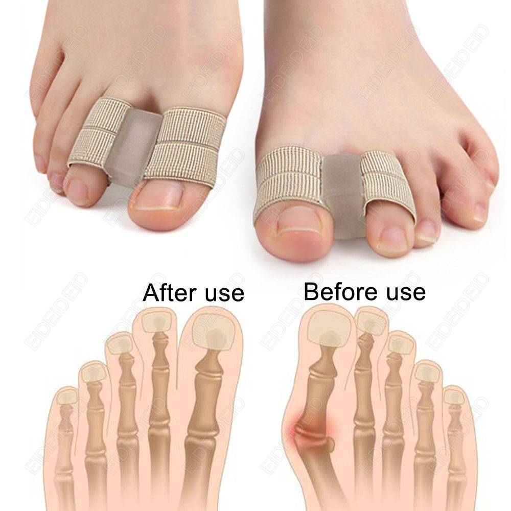 Bunion toe Corrector Orthotics - Women'S Shoes With Bunions ulasan dan harga